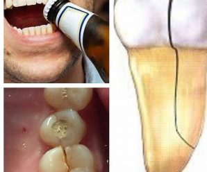 HÁBITOS QUE PUEDEN ESTROPEARTE LOS DIENTES