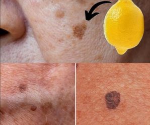 El poder del limón: Cómo eliminar las manchas oscuras del rostro de forma natural