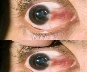 Mucha atención: Si tus ojos tienen estas señales, tu cuerpo está enviando una advertencia cuidado