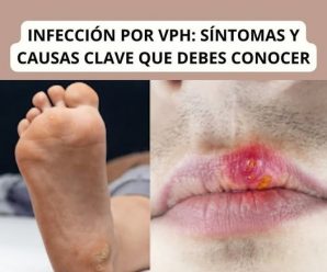 INFECCIÓN POR VPH: SÍNTOMAS Y CAUSAS CLAVE QUE DEBES CONOCER