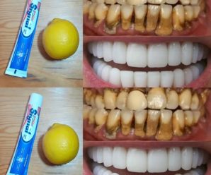 Blanqueamiento dental natural en casa en un día: ¡un método probado!