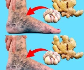 Ajo y jengibre: el dúo natural que combate eficazmente las varices