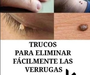 Elimina las manchas, arrugas de tu rostro y blanquea tu piel