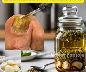 ¿Te gustaría eliminar los hongos de tus uñas?