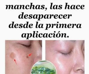 Eliminar las manchas de la cara es posible, con esta loción casera de perejil