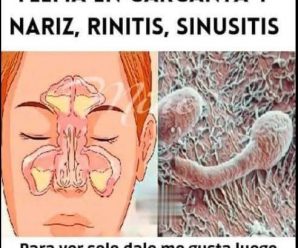 « Remedios naturales efectivos para aliviar la tos y eliminar la flema de los pulmones »