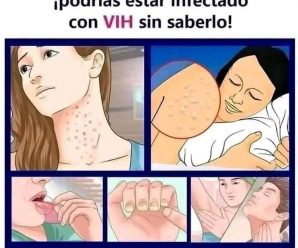 🚨ATENCIÓN a estos síntomas ‼ Podrías estar infectado con VIH sin sab…Ver más