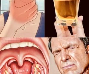 Remedios para Eliminar el Dolor e Infección de Garganta: Recetas Detalladas, Consejos y Más