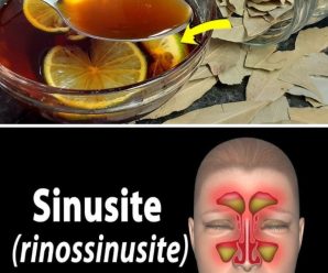 Xarope Caseiro para Tosse, Sinusite e Rinite Alérgica: Alívio Natural e Eficiente!