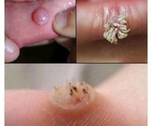 Alerta de salud: Causas y consejos para lidiar con ampollas en la boca
