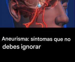 ¿Qué es un Aneurisma? Causas, Síntomas y Cuándo Buscar Ayuda
