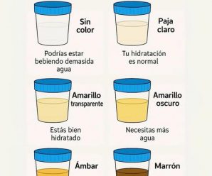 COLOR DE LAS ORINAS