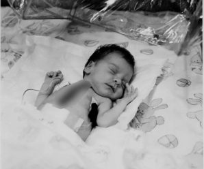Baby Fae: ¿Qué sucedió cuando una niña recibió un trasplante de corazón de un babuino?