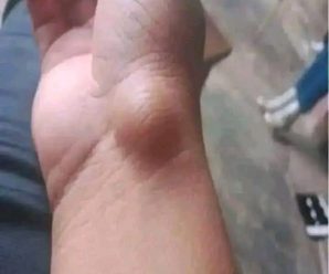 Ojo, mucha atención a estos síntomas porque puede ser…Ver Más