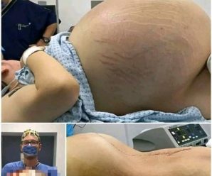 Fue al Hospital a Dar a Luz y No Vas a Creer lo Que Sacaron de su vie…Ver más