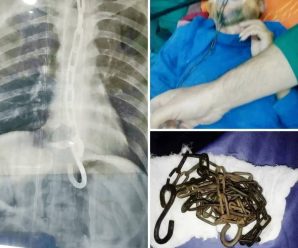 Joven fue hospitalizado por ingerir una…ver más