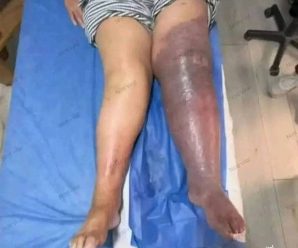 😱Estás son las consecuencias de dormir con un2…Ver más