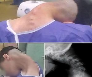 Joven hospitalizado porque se le cayó la ca…Ver más